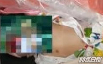 越4個月大患病女嬰未斷氣被送火葬場 父母:早日擺脫痛苦