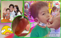 老竇大意睇少眼就出事 黎諾懿囝囝畀蚊狂針右耳大咗兩個碼