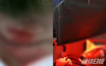 字體寫得醜 14歲學生遭班主任打爆左眼