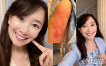 【反應太大】打完第二針疫苗手臂又紅又痕 陳美齡被網友勸快去睇醫生
