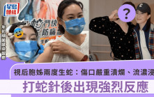 47歲視后胞姊兩度生蛇打蛇針現強烈反應   年初不慎細菌感染延遲診治致額頭疤痕