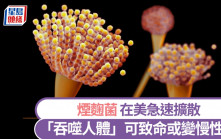 煙麴菌｜致命真菌入侵美國急速擴散 「從內部吞噬人體」