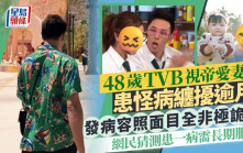 48歲TVB視帝愛妻患怪病纏擾逾月  發病容照面目全非極詭異  網民猜測患一病需長期服藥