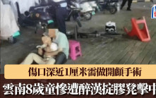 雲南8歲童慘遭醉漢掟膠凳撃中頭  傷口深近1厘米需做開顱手術