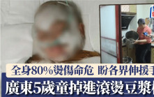 廣東5歲童掉進滾燙豆漿桶  全身80%燙傷命危