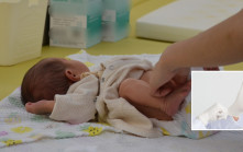 無戴手套為2歲子換尿布 一家四口全感染諾如病毒