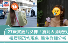 27歲賀歲片女神竟「瘦到大腸現形」？扭腰現恐怖現象  醫生詳細分析：和大便有關