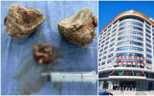 破健力士紀錄  東莞男子身上取出834克重的腎結石 ︱如何防止腎石？