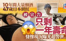 酗酒摧毀身體  47歲日本網紅只剩一年壽命  PO「巨肚」照震撼網民
