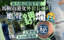 與大媽迎面撞手臂 馬鞍山港女外套長袖衫應聲鎅爛 上臂留Ｘcm長傷痕｜Juicy叮