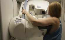 预防乳癌︱美医疗机构修订标准  女性40岁起应每2年接受1次检查