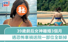 39歲劇后女神離婚3個月  遇恐怖車禍被拖行數公尺  送院一部位全部斷掉