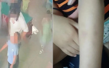 5歲童：「老師一天沒打我真開心」 家長查監控揭17天內日日挨打