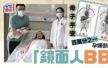 概率僅百萬分之一 武漢夫妻誕下內臟左右相反「鏡面人BB」
