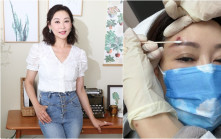 楊卓娜兩度生蛇眼角留永久疤痕 誤當蟲咬錯過黃金治療期丨獨家