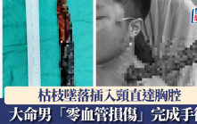 死神擦肩｜大命男遭枯枝插頸直達胸腔  靠「零血管損傷」手術逃鬼門關