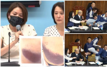 台灣立法院MMA︱國民黨女議員公開腰臂受傷照淚灑記者會  「超大片瘀青」