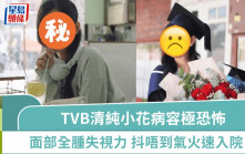 TVB最清純小花晒病容照極恐怖  半小時內面部全腫奪去視力  抖唔到氣火速入院