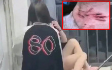玻璃割頸︱湖南14歲女自殘求同學停毆打  公安：已請檢察機關提前介入