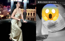 35歲前TVB女星回巢探朋友後出事   下巴爆缸成臉血傷勢曝光