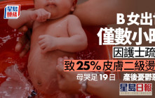 初生B女出世僅數小時 即因護士疏忽致25%皮膚二級燙傷