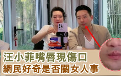 汪小菲臉上再現傷痕   網民好奇是否又關女人事