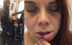 搭地铁不满身边乘客叉开脚坐 纽约女子被打至嘴角流血