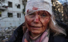 俄乌局势｜乌克兰妇女受伤照片 控诉战争残酷