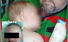 新西兰狠父虐打9个月大儿子致重伤断舌 轻判「在家坐监」9个月