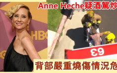 《觸目驚心》Anne Heche疑酒駕炒車    背部嚴重燒傷情況危殆