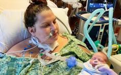 美國30歲確診孕婦昏迷20天 醒來發現已誕下小男嬰