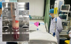 長期過量喝奶茶 22歲女教師腹痛昏迷入ICU抽出牛奶血