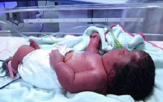 深圳母亲为保胎7个月打过百支针 孩子出生竟是畸形