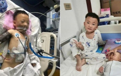 4岁奇迹男孩 28楼堕下重伤1个月后已能站立
