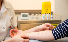 養和推檢查服務 助有過敏病史市民選擇合適新冠疫苗 