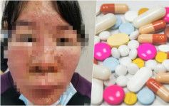 深圳女子7种感冒药混合服用 全身长满红斑及脓疮