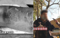 东张西望丨电动车横行天水围危险四伏  曾被撞伤受害者展示伤势