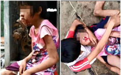 粵9歲女童丟失課本遭親母毒打 官方調查民間捐款2萬多元
