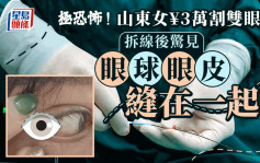 恐怖整容｜女子¥3万割双眼皮    拆线后「眼球和眼皮被缝在一起」