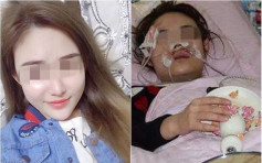 天津25歲女子摸流浪狗慘遭咬臉 皮開肉裂毀容