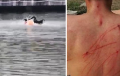 男大学生湖里游泳惨遭黑天鹅暴啄 背脊伤痕累累