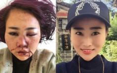 丽江女游客遭殴打毁容案 6被告最高判囚3年半