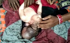 印度婦誕3頭女嬰 民眾排隊朝聖参拜：神明化身