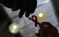 愛滋病治療新希望   荷蘭科學家成功從細胞上「切除HIV」