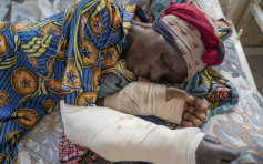 剛果東部營地遭叛軍轟炸 3名平民死亡8人受傷