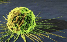 新药对付半数抗药性癌症 减慢癌细胞生长速度