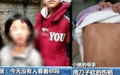 贵州8岁女童被拐受虐3年　逃出生天凭记忆走回家
