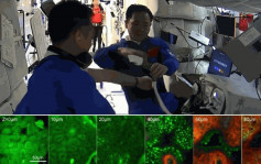 神十五雙光子顯微鏡在軌實驗成功 首獲太空人皮膚三維圖像