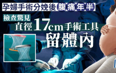 17厘米直径手术工具遗留体内  新西兰妇产后腹痛长达18个月