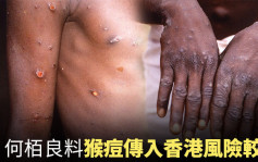 猴痘传染性不高 何栢良料传入香港风险较低
